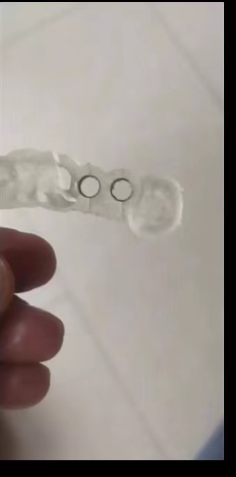 คู่มือการปลูกเครื่องพิมพ์ 3D ท - 3D Printing Dental บทวิจารณ์และราคา