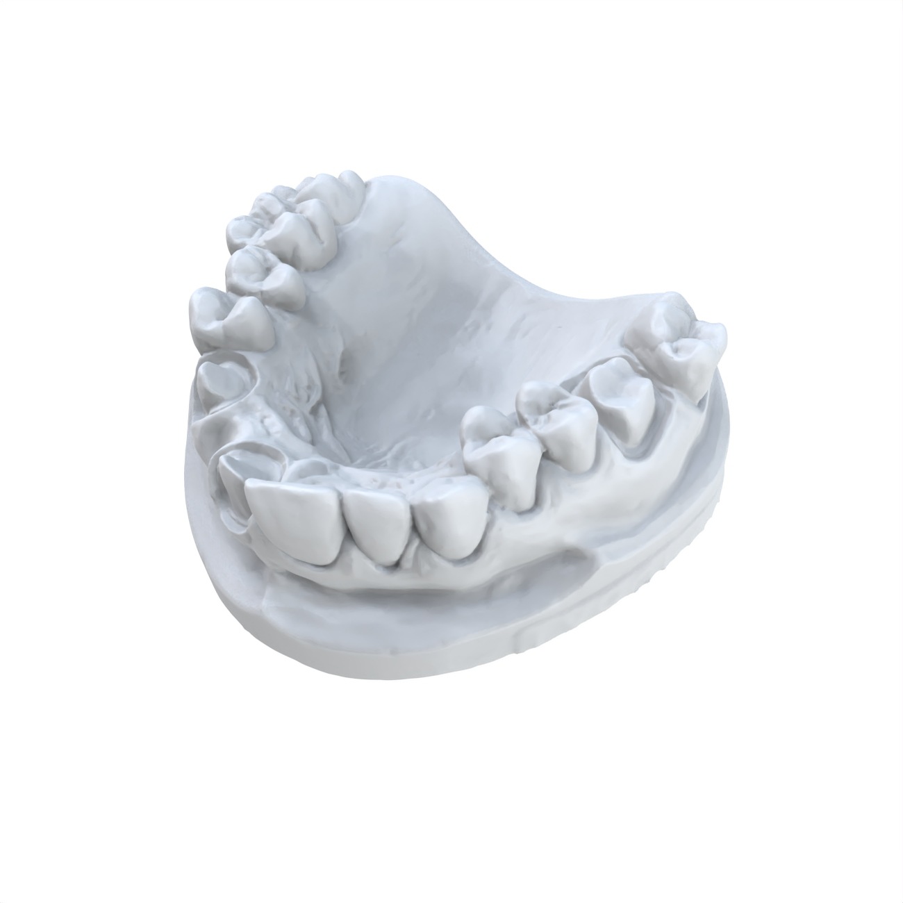 วัสดุเรซิ่นไวแสงสำหรับพิมพ์แบบ - 3D Printing Dental บทวิจารณ์และราคา