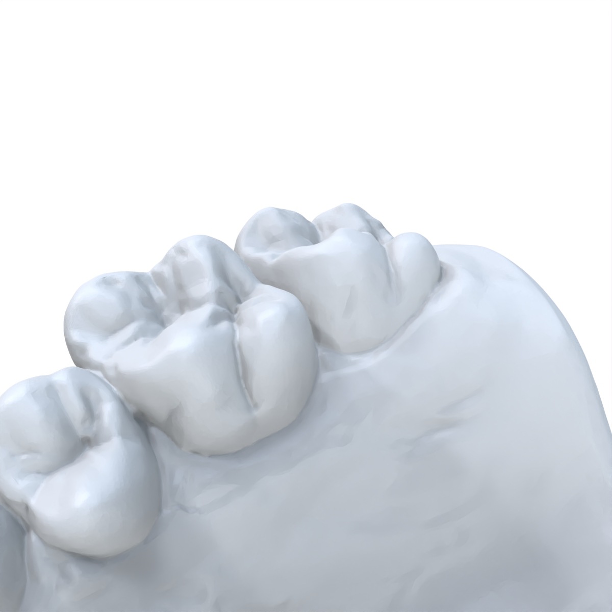 วัสดุเรซิ่นไวแสงสำหรับพิมพ์แบบ - 3D Printing Dental บทวิจารณ์และราคา